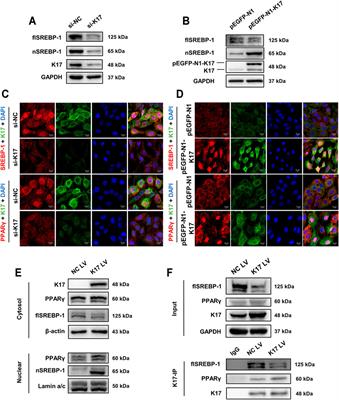 Keratin 17 Is Required for Lipid Metabolism in Keratinocytes and Benefits Epidermal Permeability Barrier Homeostasis